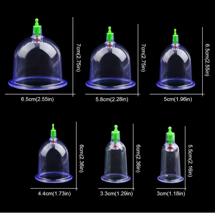 vacuum therapy cupping - photo 2