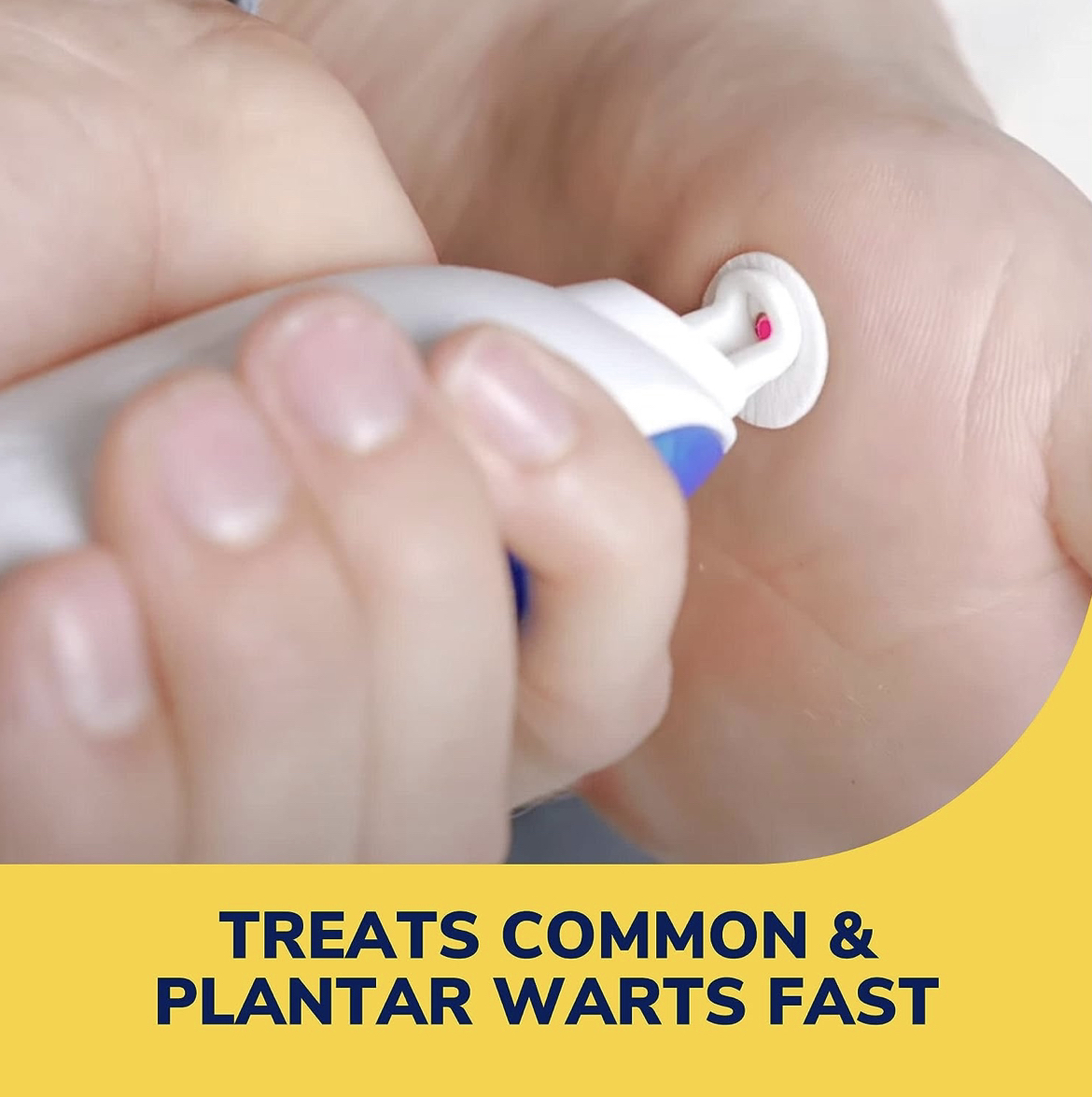 Wart Remover image indicator(3)