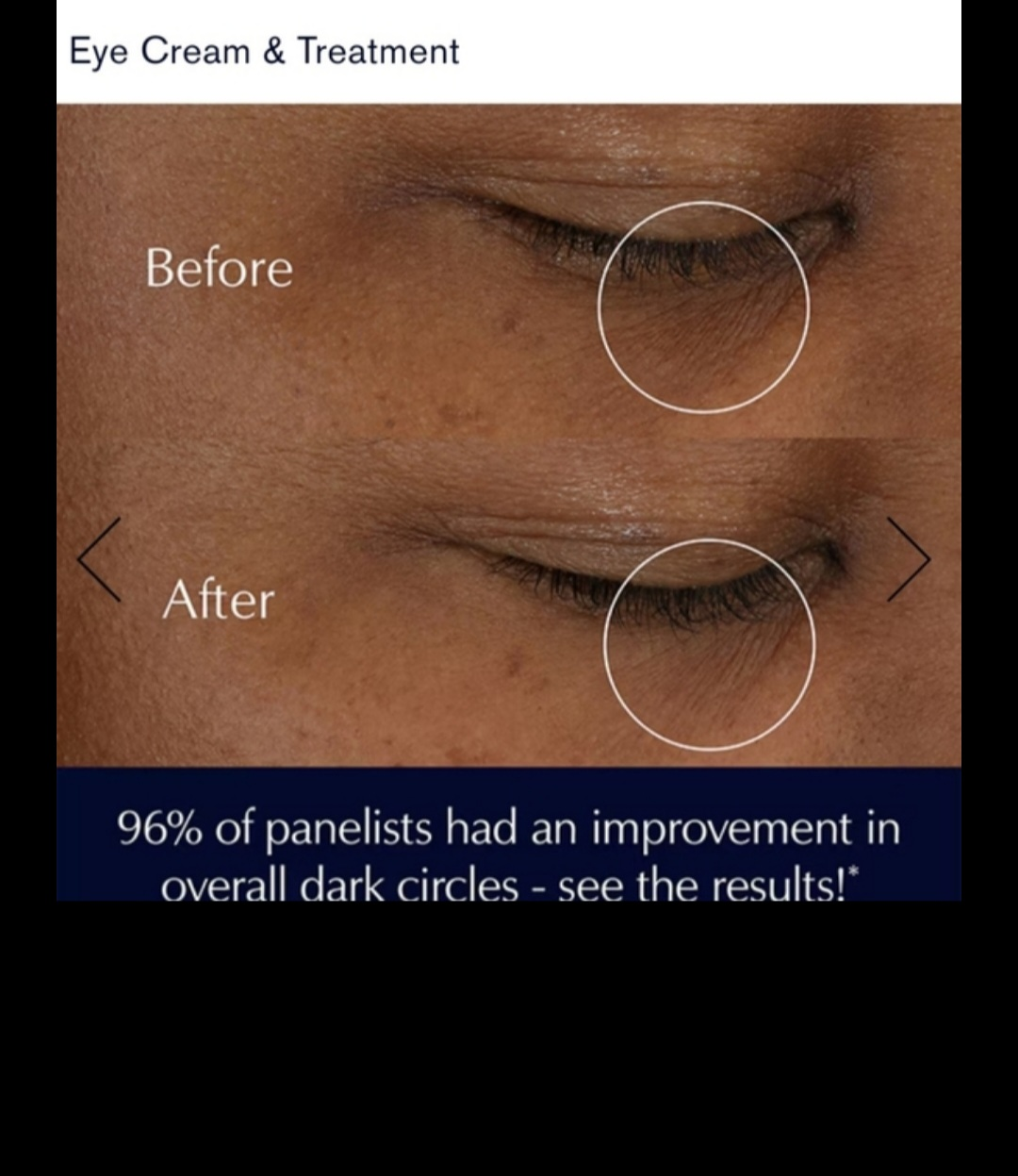 Estee Lauder Advanced Night Repair Eye Cream/Treatment image indicator(3)