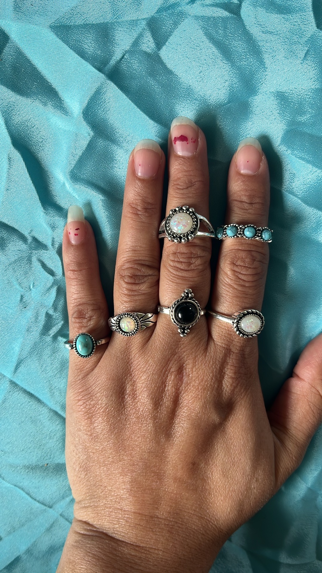 Artificial rings