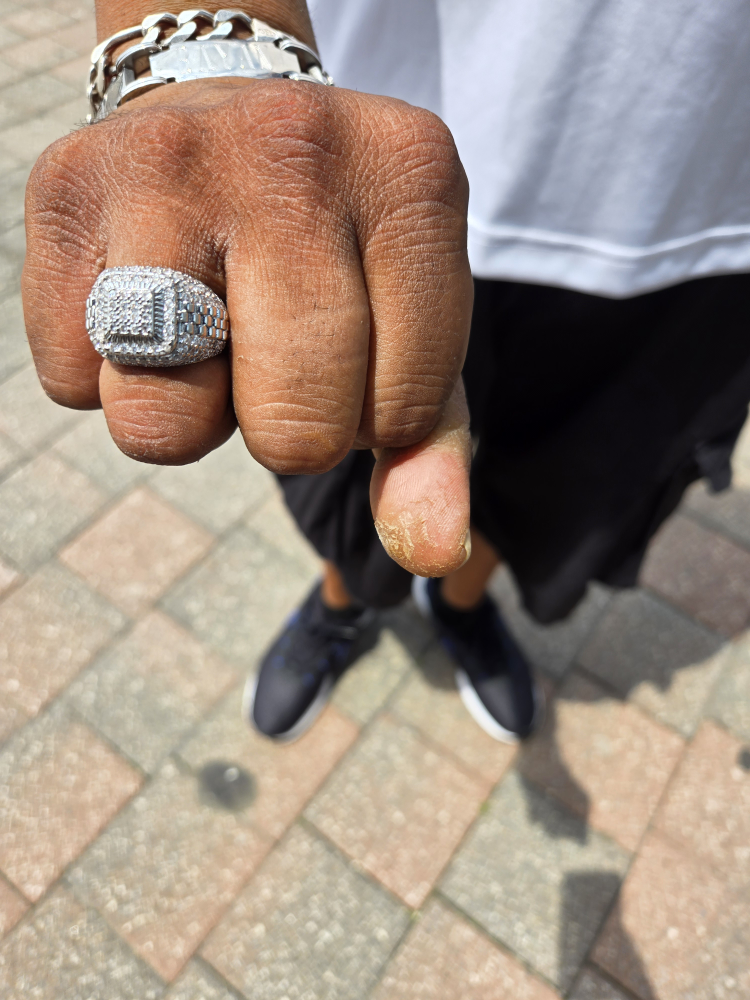 Neck and and ring - photo 5