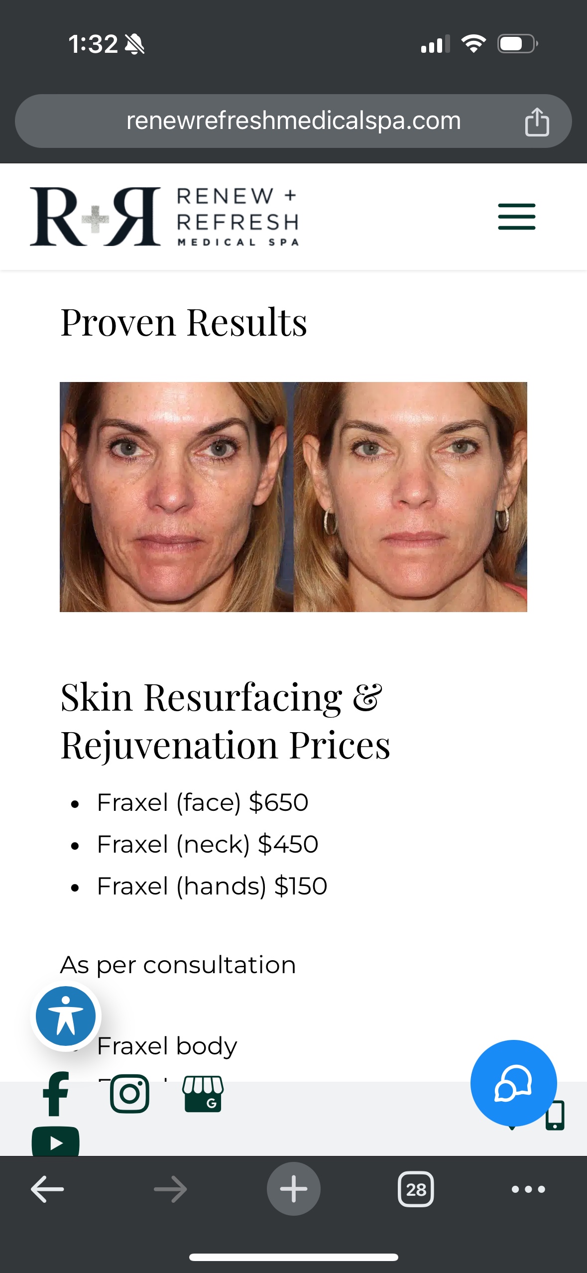 fractional facial from Renew Refresh in Cochrane - photo 5