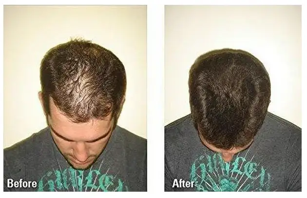 Hair Thickening Fibres image indicator(3)