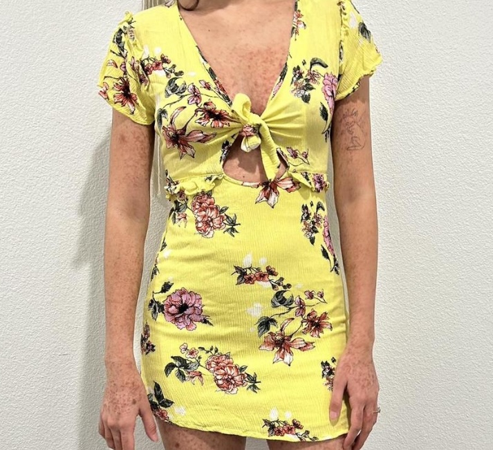 BLEUH CIEL 100% RAYON FLORAL OPEN BACK DRESS - photo 4