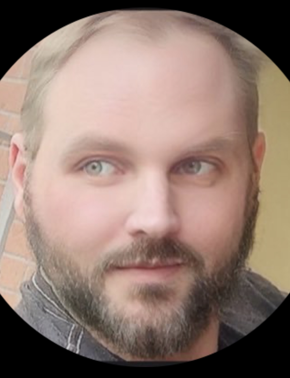 Myers profile